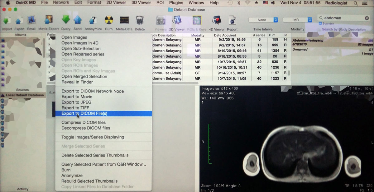 osirix dicom are password protected